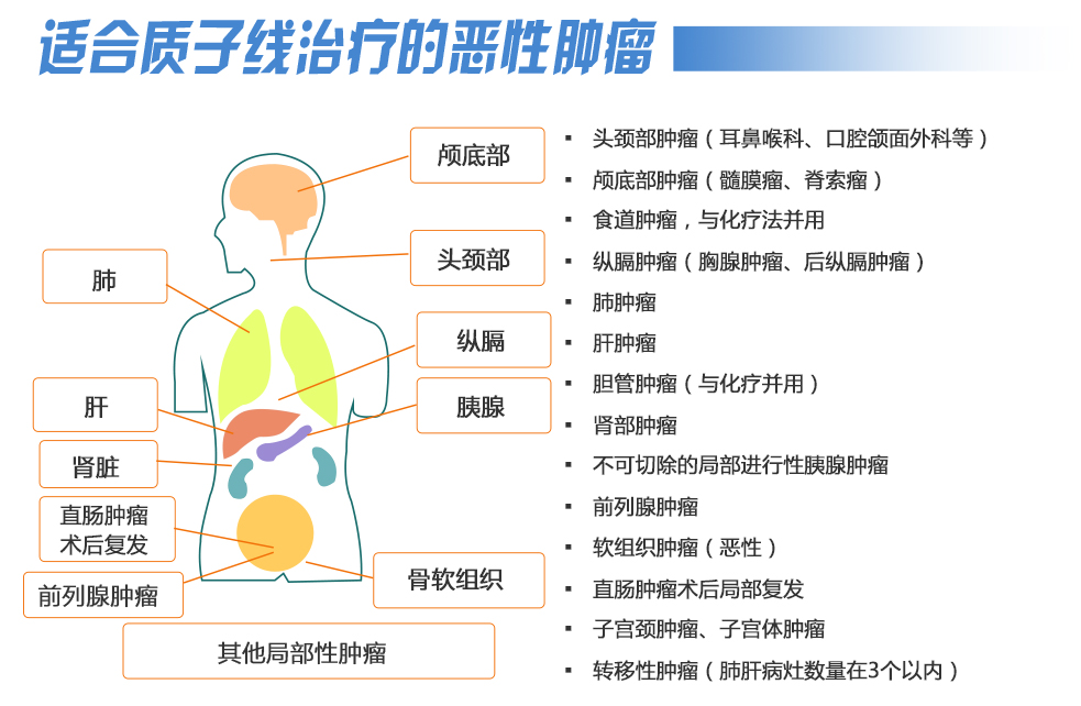 質(zhì)子治療腫瘤