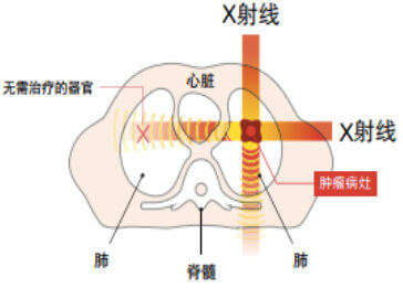 癌癥治療