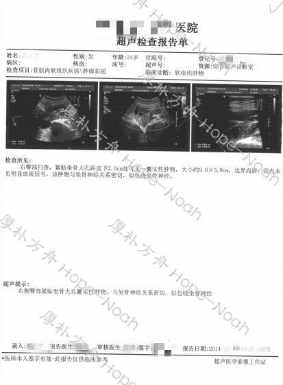 梭形細胞肉瘤治療