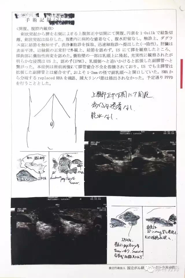 日本手術記錄