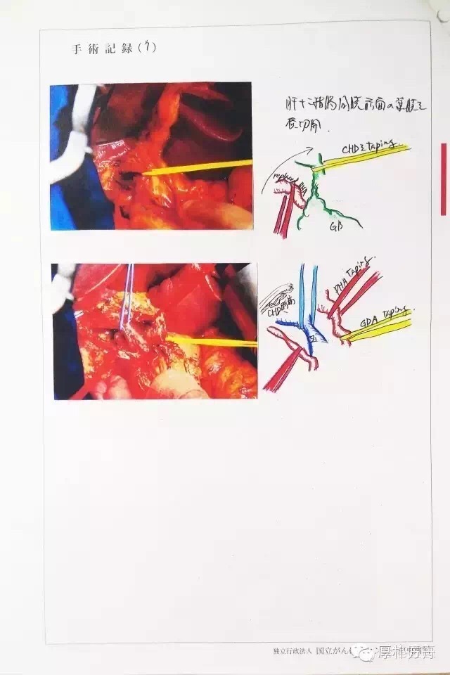 日本手術記錄