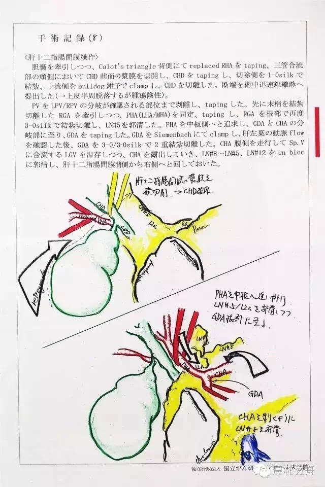 日本手術記錄