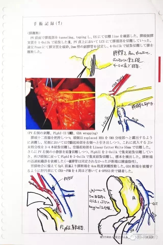 日本手術記錄