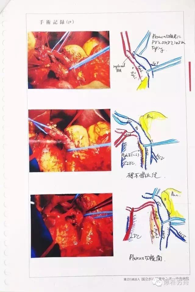 日本手術記錄
