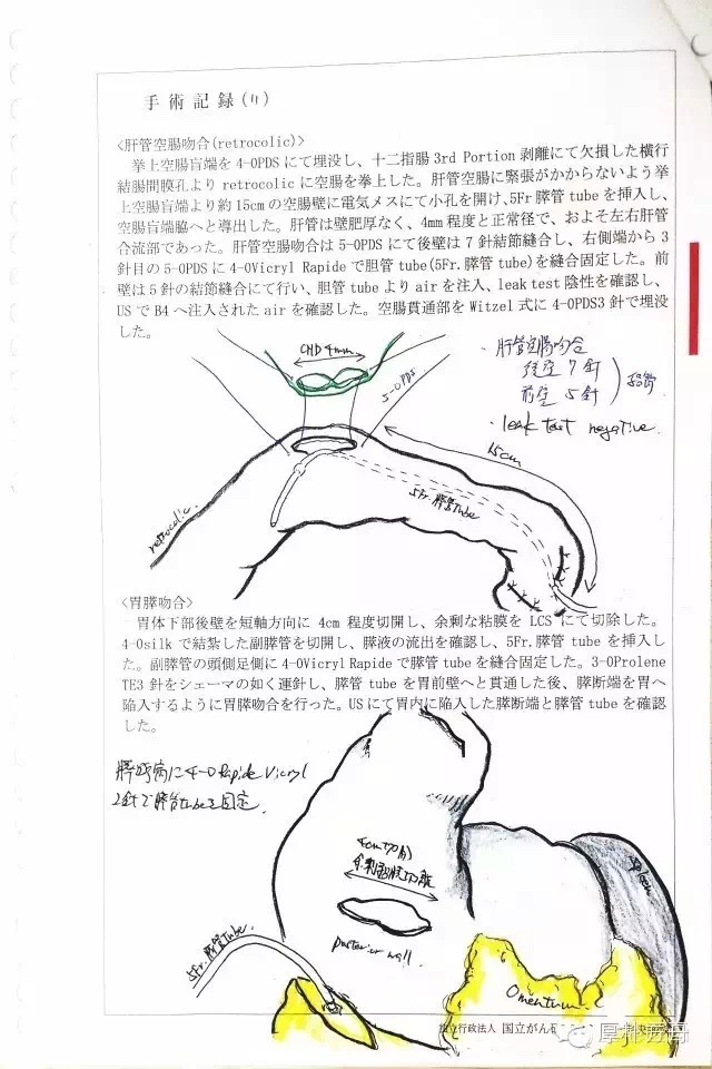 日本手術記錄