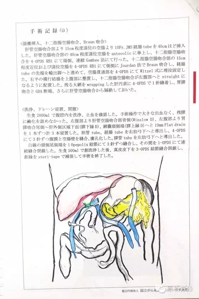 日本手術記錄