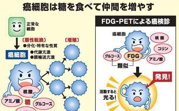 日本PET-CT