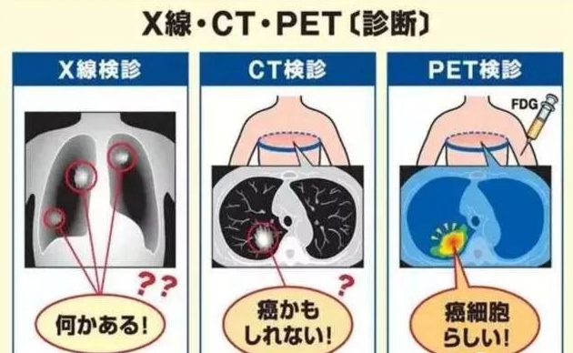 赴日體檢