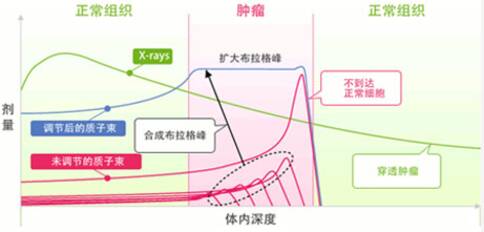 日本質(zhì)子治療