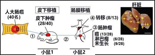 大腸癌轉(zhuǎn)移治療新靶點(diǎn)