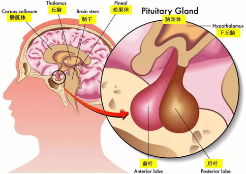 腦垂體瘤分類