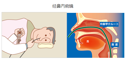 日本電子胃鏡