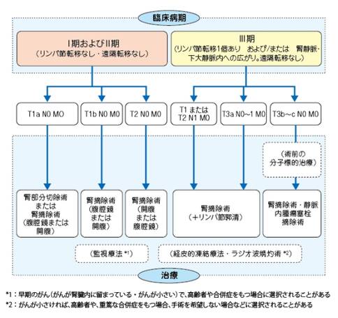 日本腎癌治療方法