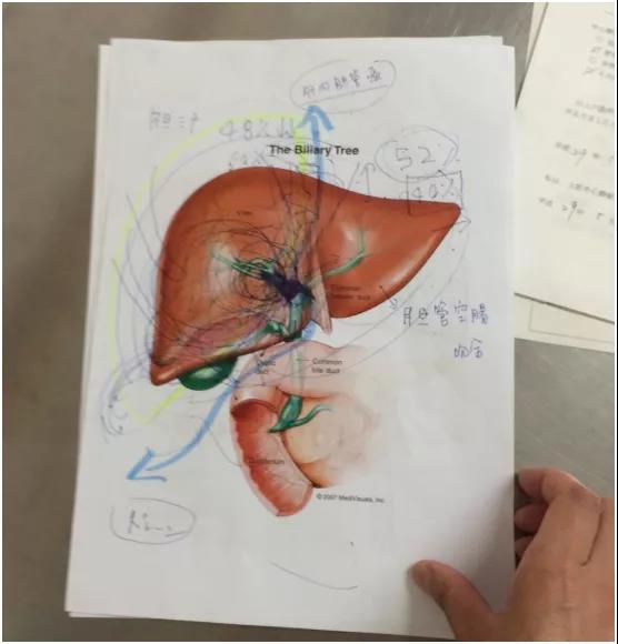 膽管癌治療方案