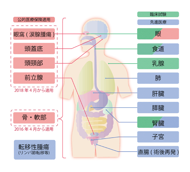 重離子治療適應癥