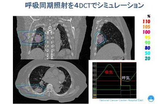 日本質(zhì)子重離子治療