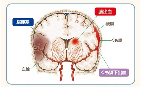 腦?？祻?fù)治療