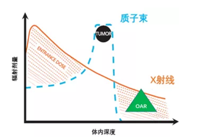 質(zhì)子治療鼻咽癌