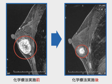 日本治療乳腺癌醫(yī)院排名