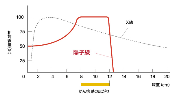 質(zhì)子治療頭頸癌