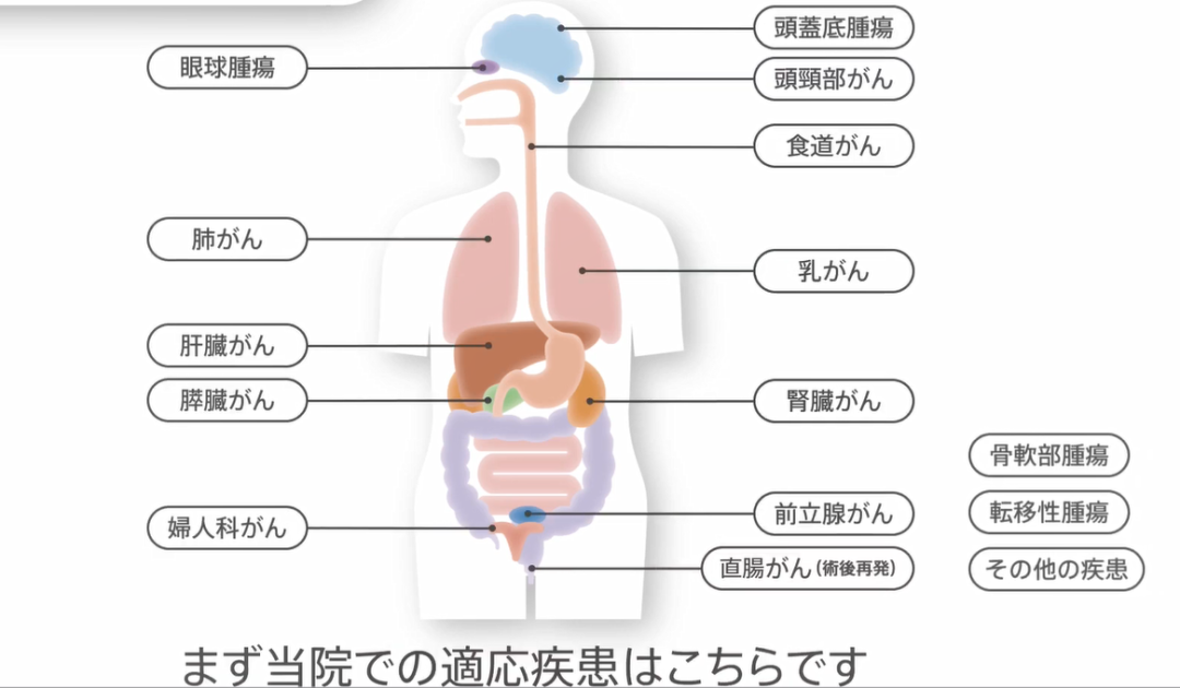 日本重離子治療