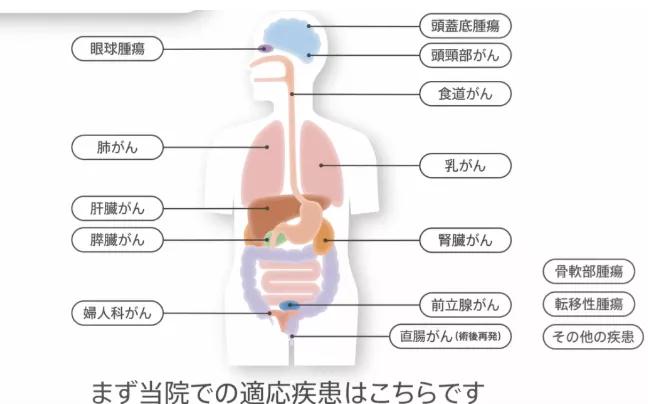 質(zhì)子重離子治療