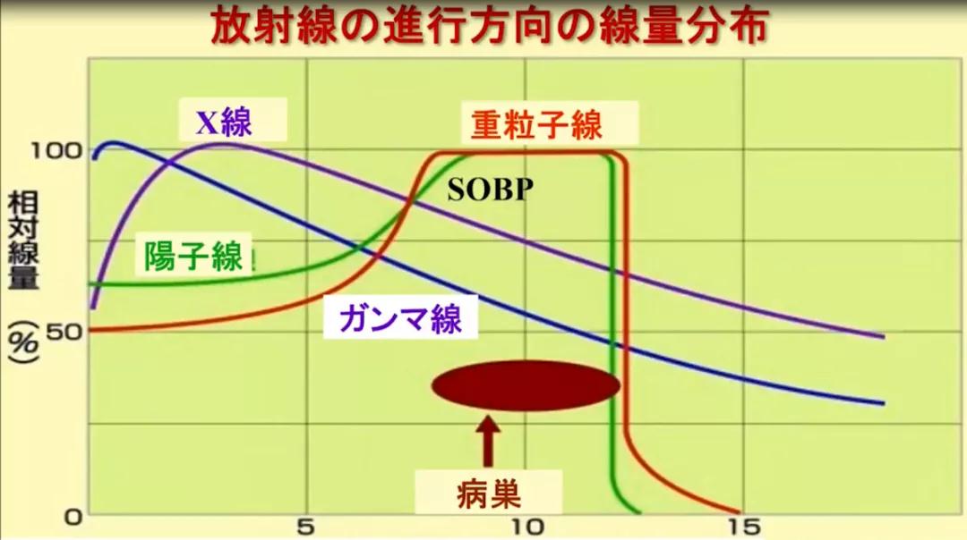 質(zhì)子重離子治療