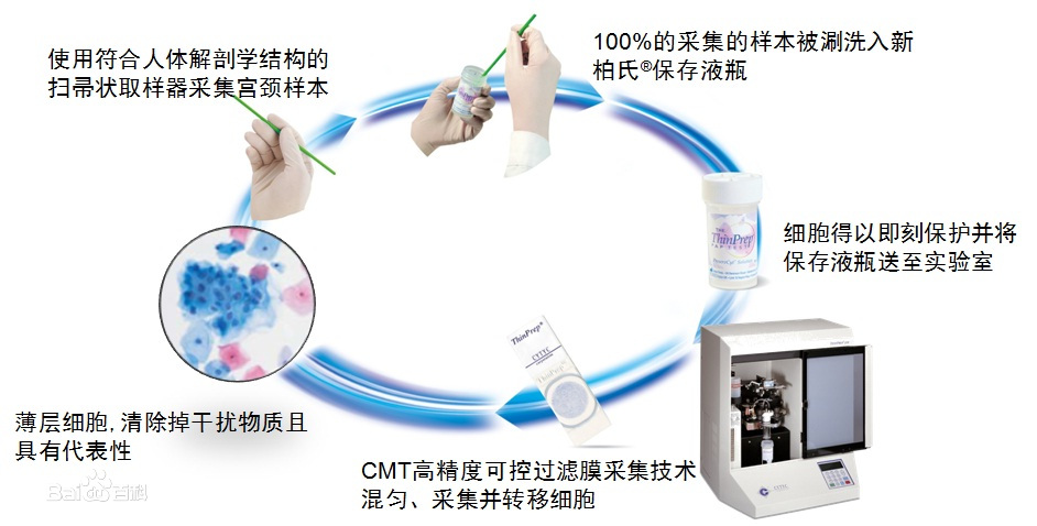 TCT檢查流程