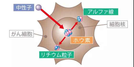 日本硼中子俘獲治療