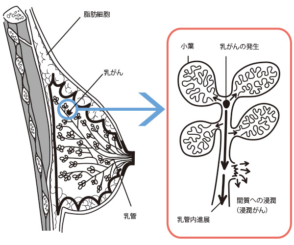 乳腺癌醫(yī)院