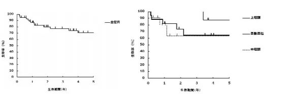 鼻咽癌質(zhì)子治療