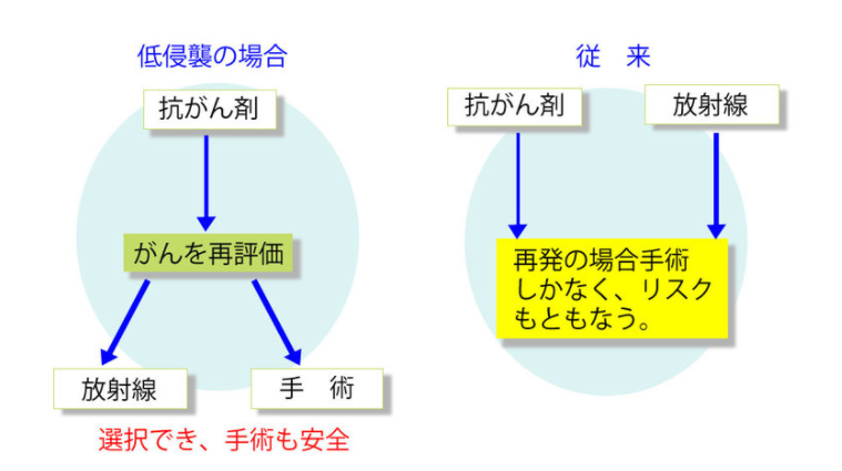 放療化療串聯(lián)方案